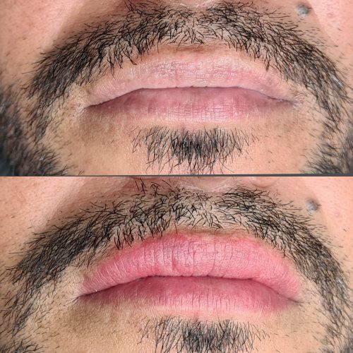 InCollage_20220708_105450041-min