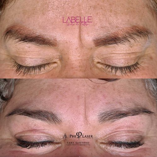 react_native_image_overlay_2 nov. 2021 8_17_02 a. m.-min